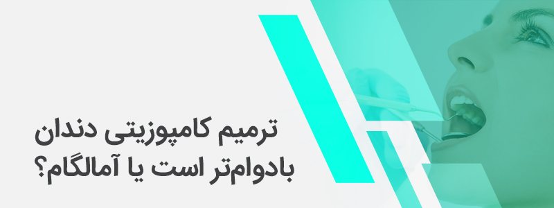 بنر مربوط به ترمیم کامپوزیتی دندان بادوام‌تر است یا آمالگام؟