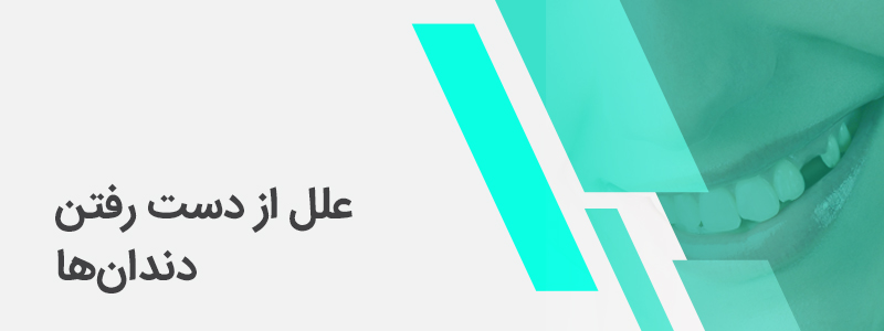 بنر مربوط به ویدئوی از دست رفتن دندان‌ها