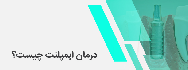 بنر مربوط درمان ایمپلنت چیست؟