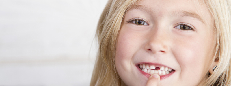 نکاتی که والدین باید درباره دندان‌های دائمی بدانند