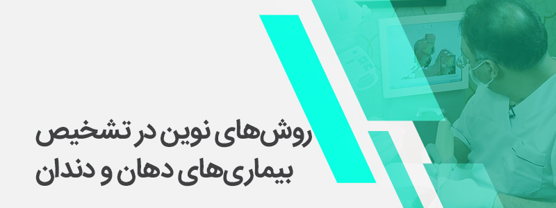 روش‌های نوین در تشخیص بیماری‌های دهان و دندان