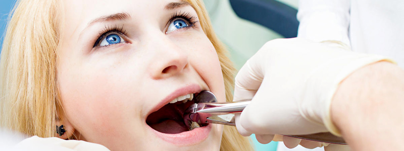 علائم رایجی که نشان می‌دهد زمان کشیدن دندان عقل فرارسیده است