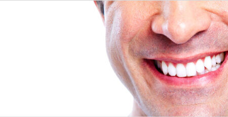 10 استراتژی مقابله با حساسیت به سفید کردن دندان