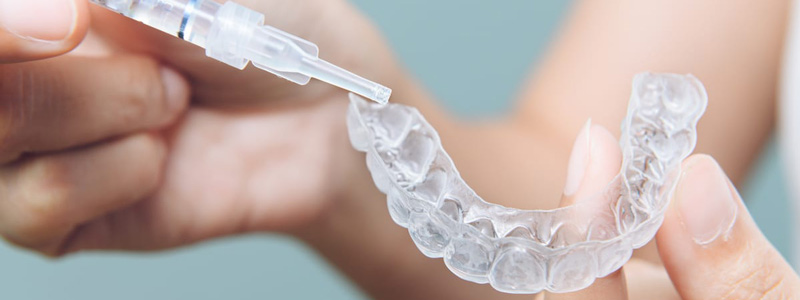 بلیچینگ دندان: آشنایی با انواع روش‌ها و مراحل سفید کردن دندان